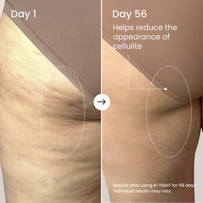 MAËLYS B-TIGHT Lift & Firm Booty Mask - Skin Tightening & Firming Cream for Booty & Thighs - Cellulite Cream with Caffeine & Brazilian Peppertree - Butt Mask for Smooth-Looking Skin (3.4 Fl Oz)