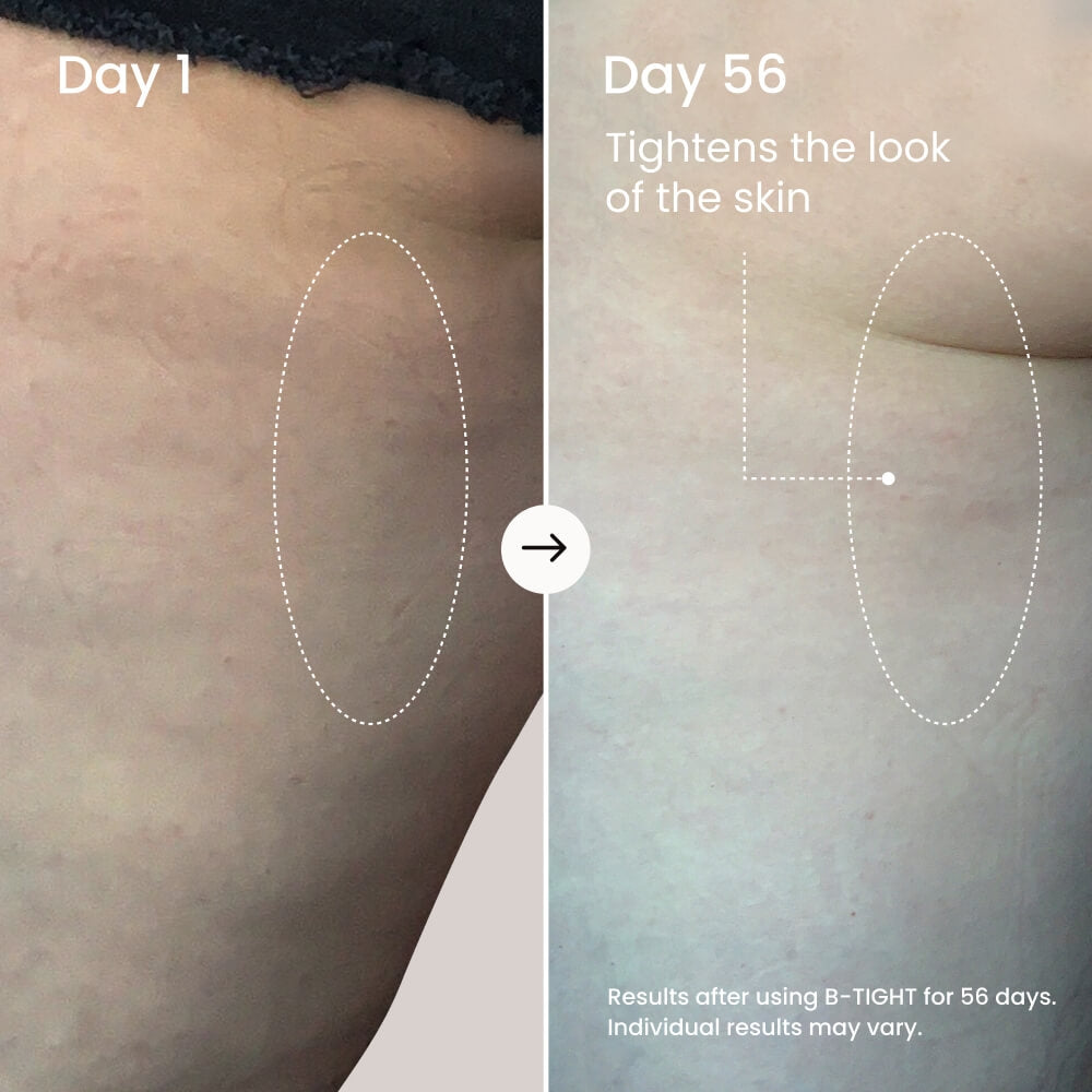 MAËLYS B-TIGHT Lift & Firm Booty Mask - Skin Tightening & Firming Cream for Booty & Thighs - Cellulite Cream with Caffeine & Brazilian Peppertree - Butt Mask for Smooth-Looking Skin (3.4 Fl Oz)