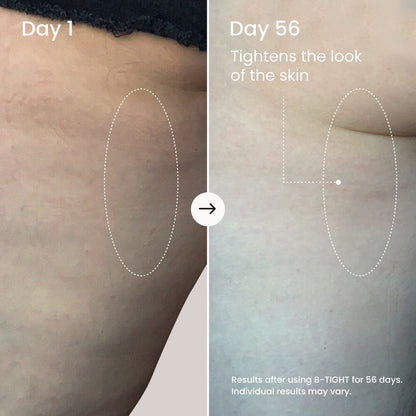 MAËLYS B-TIGHT Lift & Firm Booty Mask - Skin Tightening & Firming Cream for Booty & Thighs - Cellulite Cream with Caffeine & Brazilian Peppertree - Butt Mask for Smooth-Looking Skin (3.4 Fl Oz)