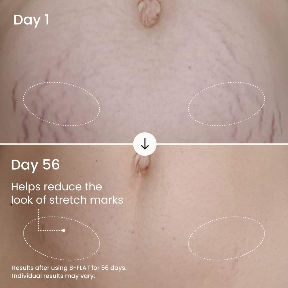 MAËLYS B-FLAT Belly Firming Cream for Women - Skin Tightening & Moisturizing Treatment with Shea Butter & Bentonite Clay - Smooths Look of Stretch Marks - Postpartum Body Care (3.4 Fl Oz)